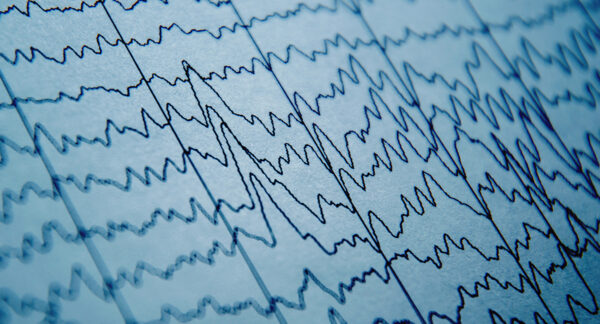 qEEG: Everything You Need to Know About Brain Mapping