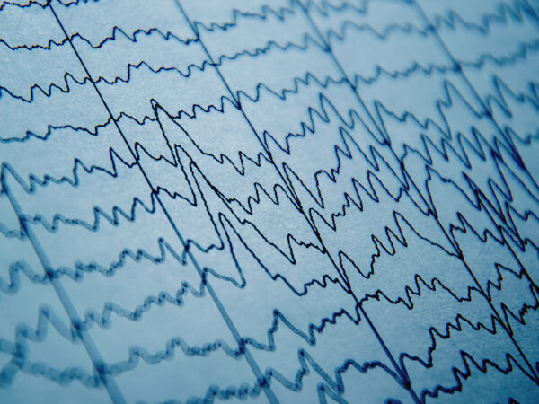 qEEG: Everything You Need to Know About Brain Mapping